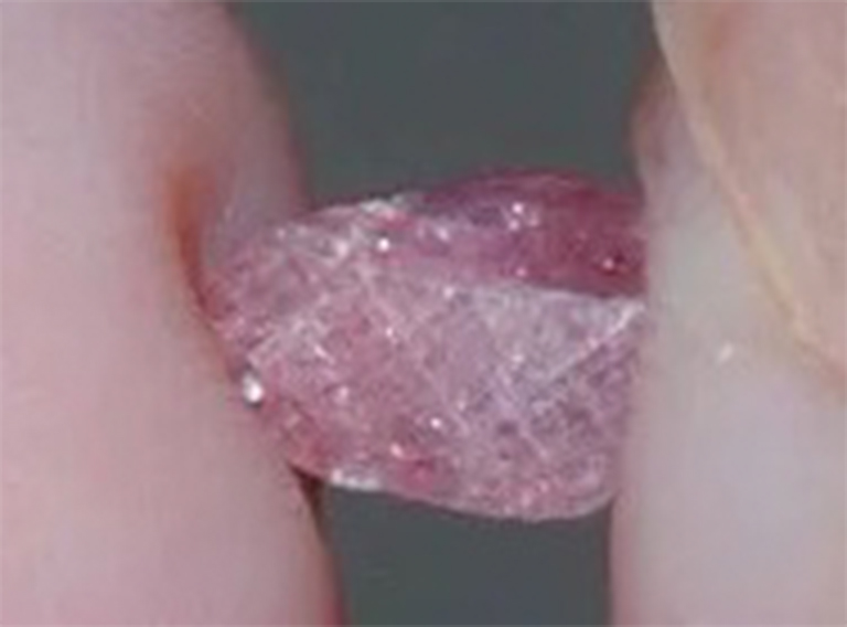 翡翠空心矿的红宝石.jpg 翡翠空心矿的红宝石