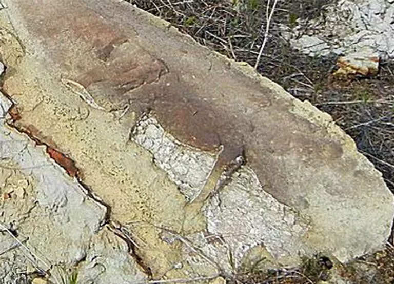 椎体积水.jpg 椎体积水